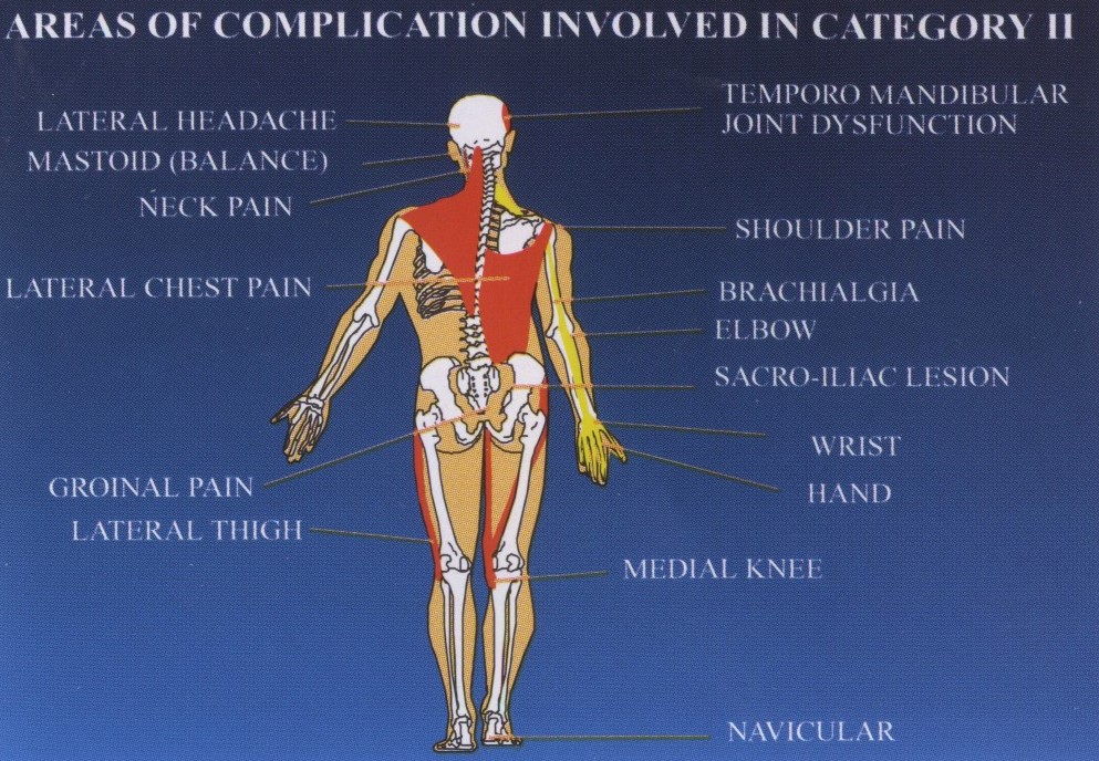 Whole Body Pain  Centurion Spine
